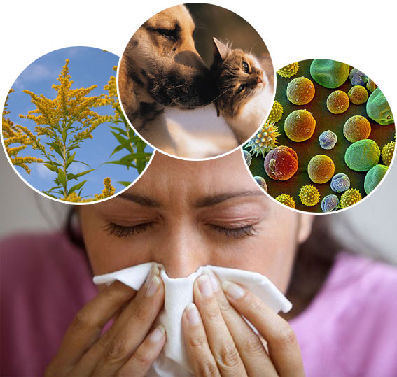 Най-странните алергии